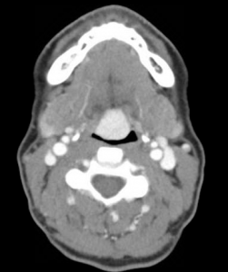 Case of the Month Answer, February 2014
